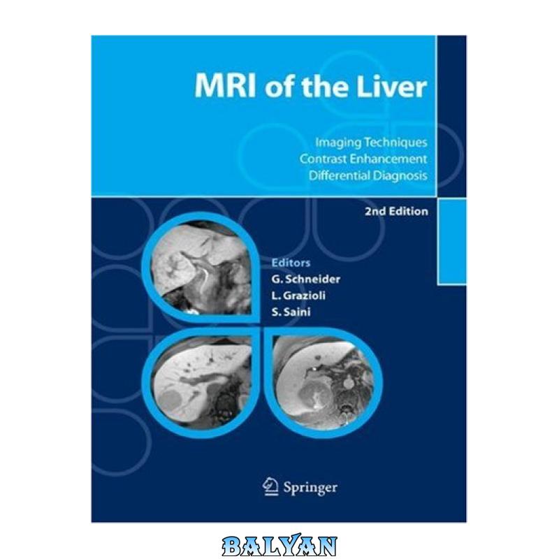 دانلود کتاب MRI of the Liver Imaging Techniques, Contrast Enhancement, Differential Diagnosis